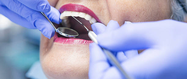 Best Emergency Treatment for Dental Infections or Abscesses in Robertsde, AL